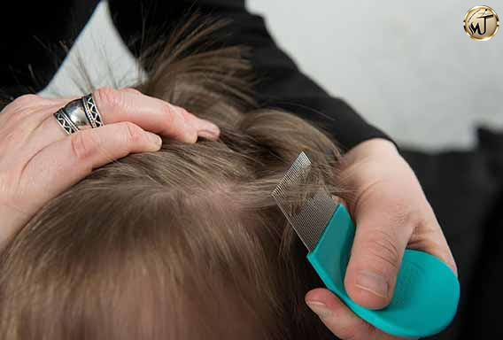 نکات پیشگیری و مدیریت شپش سر