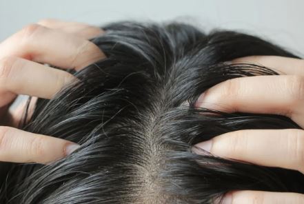 مشکلات مو و پوست سر؛ خارش پوست سر