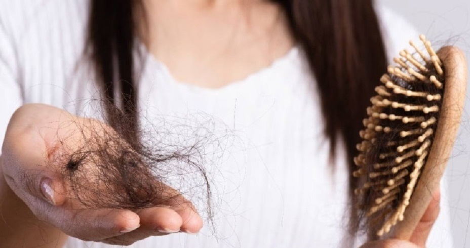نشانه‌های ریزش موی غیرطبیعی در زنان